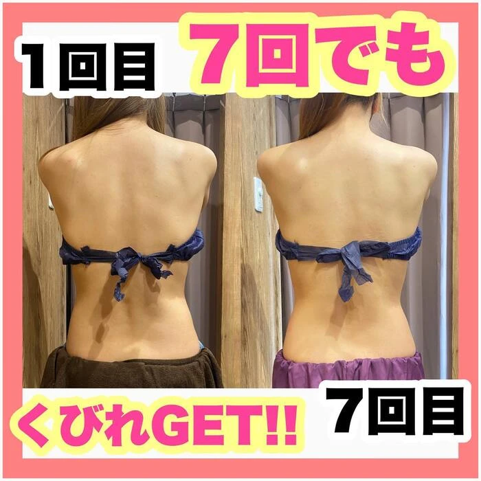 画像313