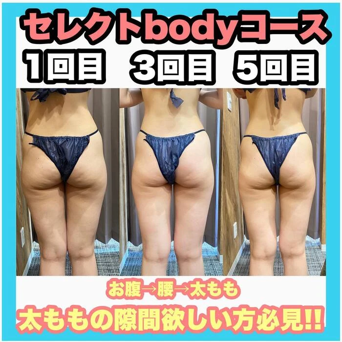 画像328