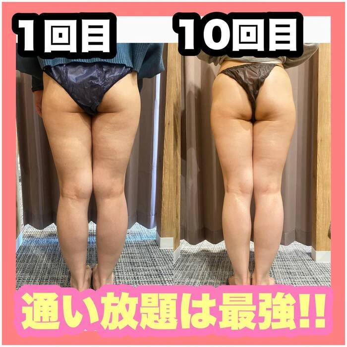 画像411