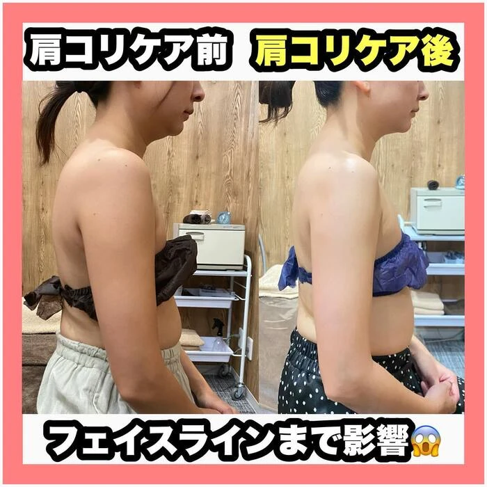 画像493